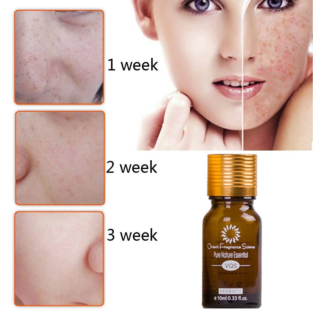 Dredge Meridian Skin Care Acne Removal