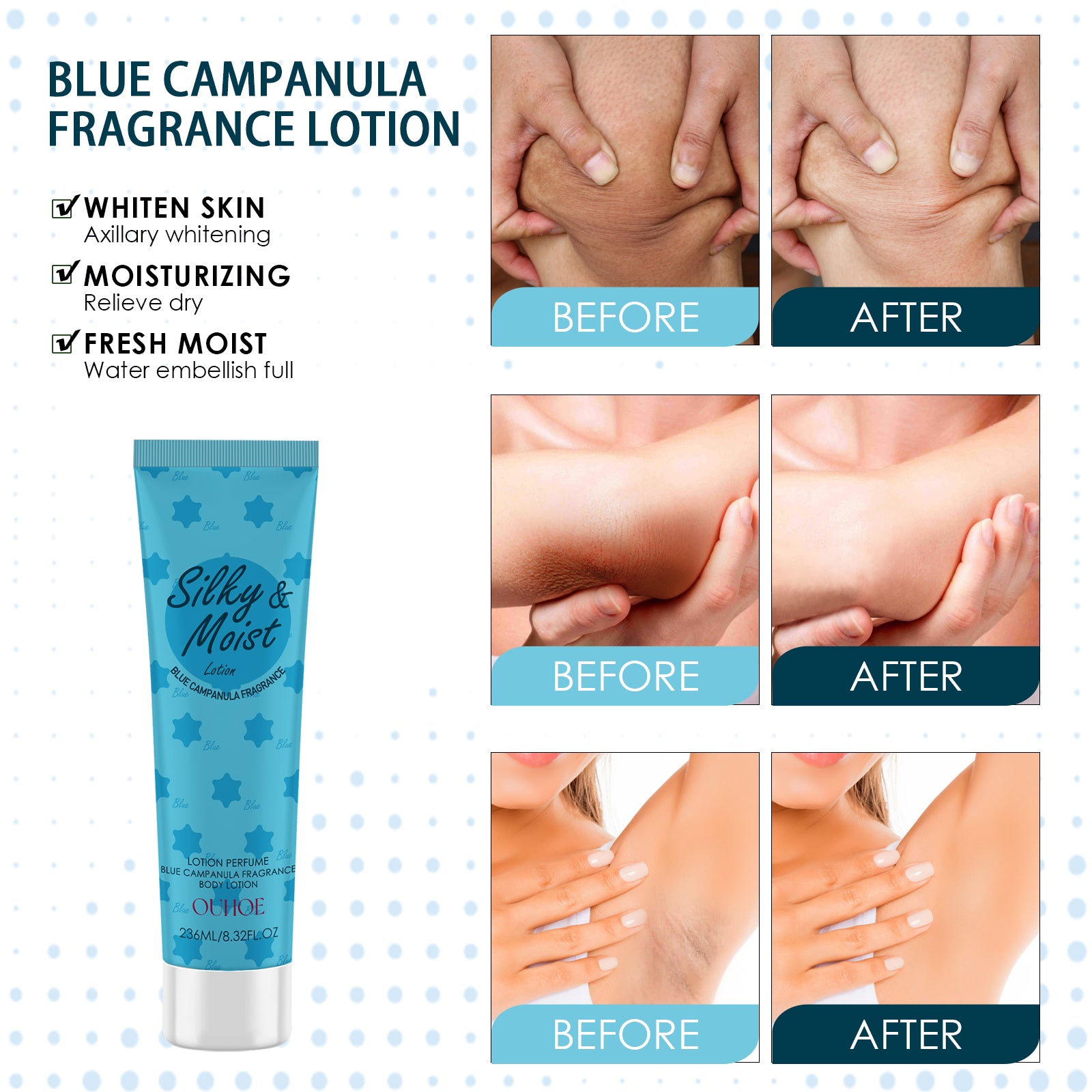 OUHOE Body Toner Lightening Armpit Knee Joint Dark Moisturizing Skin Whitening Body Beauty Care CJ